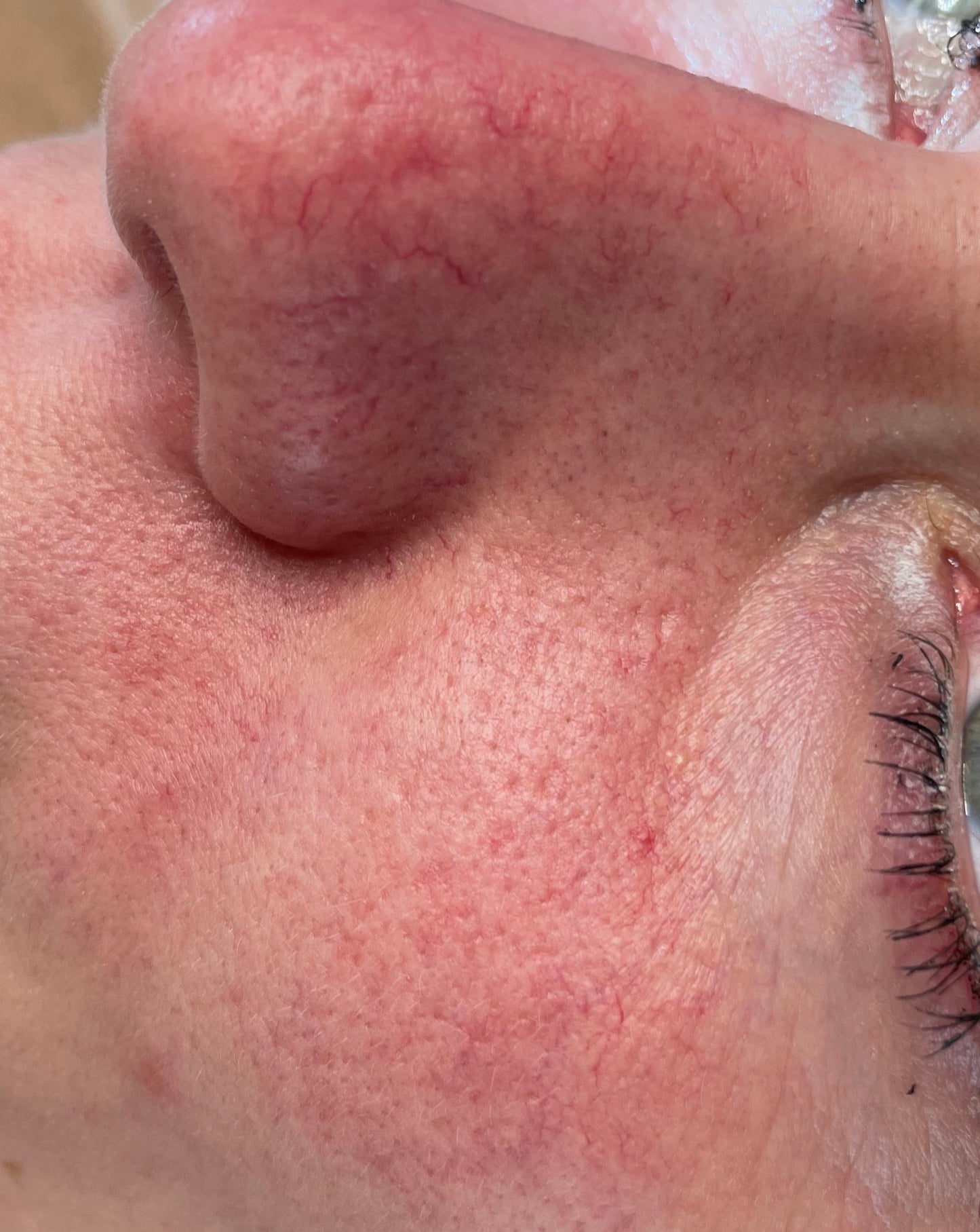 S6 Lift Couperose Serum